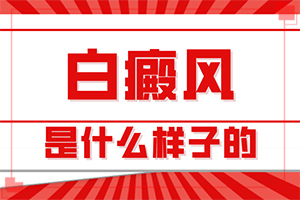 婴儿色素减退白斑是怎么造成的,哪些诱因会导致白癜风(哪些因素影响)