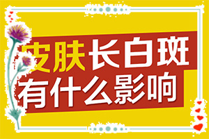 「咨询网站」怎样检查白癜风的原因？嘴唇上有白斑是什么原因