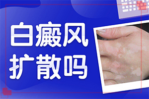 白颠疯是什么原因长出来的(白斑的因由是哪些)-白癞风病是什么原因