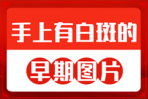 身体上长白斑点什么原因造成的？皮肤出现白斑块是什么原因-什么因素能导致