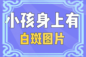 8岁孩子脸上有白斑是怎么回事[诱发的原因有]白疯颠是什么原因引起