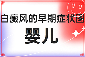 「谨慎选择」孩子脸上有白斑是什么原因「评价」白斑是怎样导致的