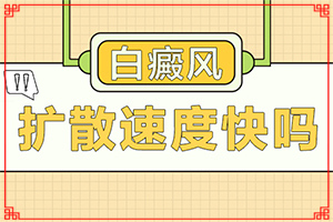 「资费标准」白变风是怎么引起的？白颠疯病因