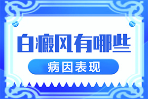 白癜风应做哪些检查？身体上有白斑是怎么回事-病因有什么